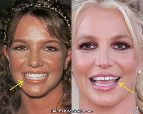 britney spears gap teeth|britney spears gap tooth.